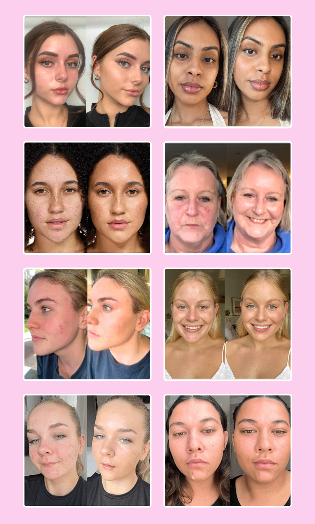 Before After Results_Breeze Balm_Pomegranate Daily Glow BB Cream