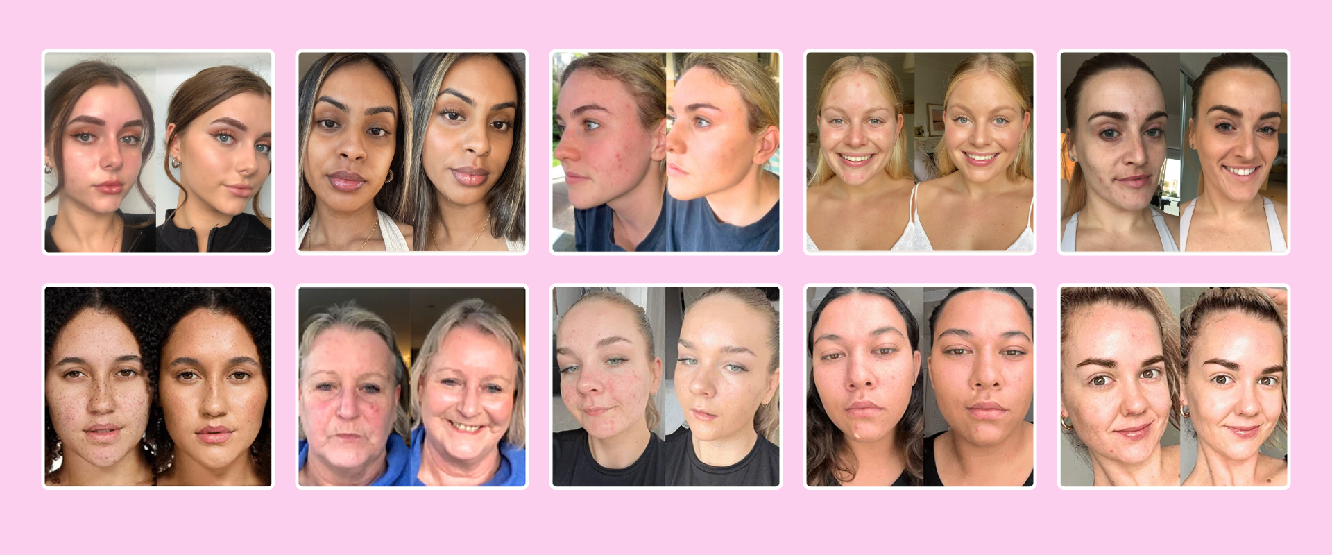 Before After Results_Breeze Balm_Pomegranate Daily Glow BB Cream